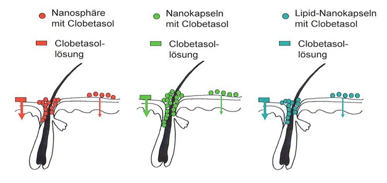 Einlagerung verschiedener Nanocarrier in das Haarfollikel und deren Einfluss auf die Arzneistoffaufnahme in die Haut. © U. Schäfer