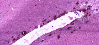 Histologische Aufnahme eines Hirngewebes mit Stichkanal einer Nadel